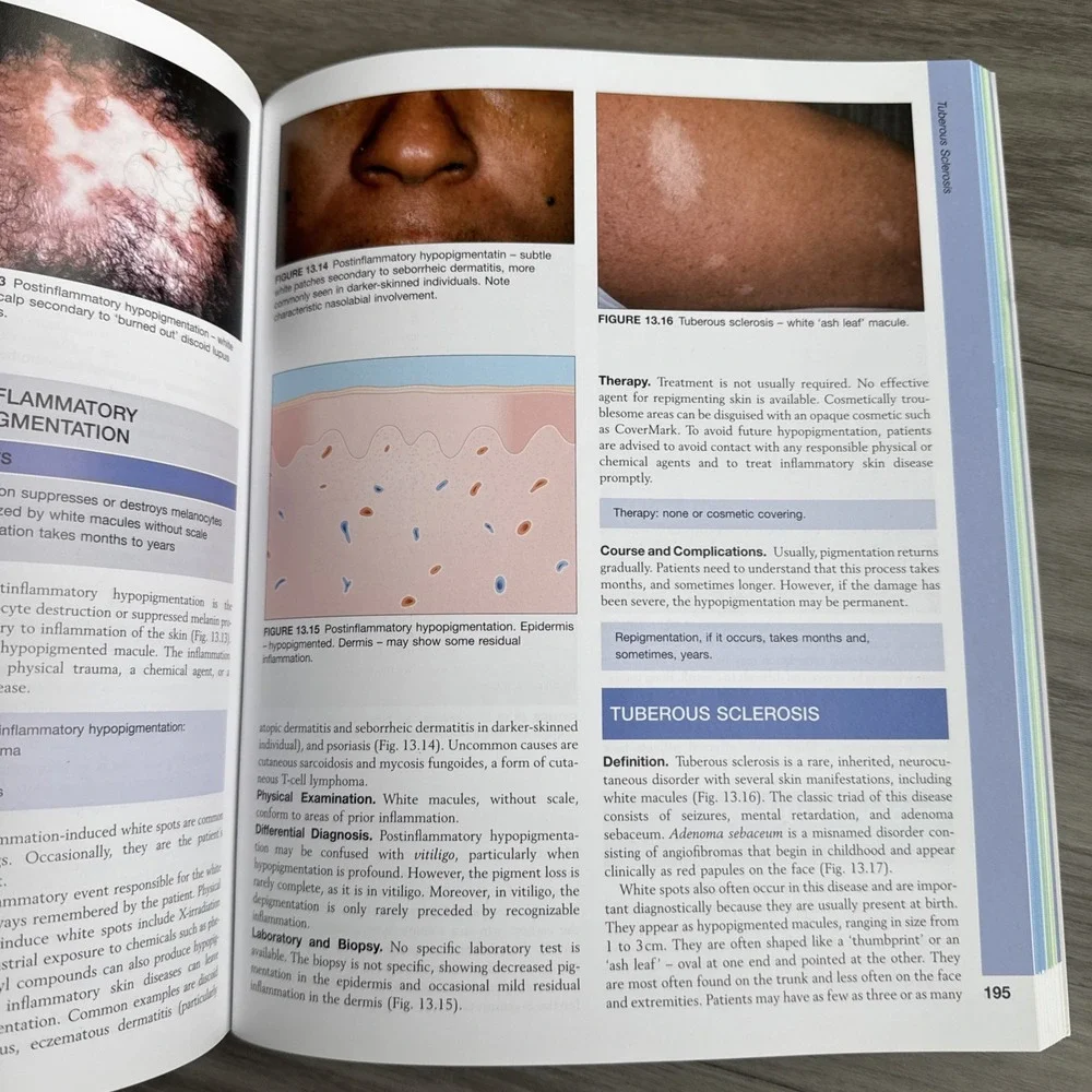Lookingbill and Marks' Principles of Dermatology, 4e (PRINCIPLES OF DERMA